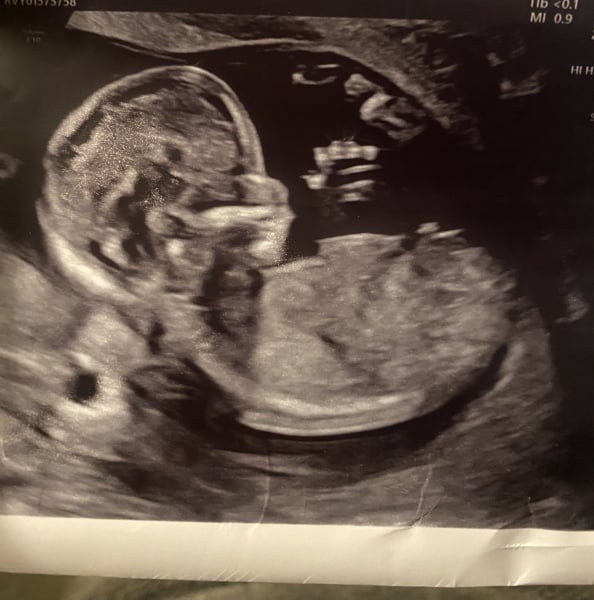 Boy or girl ? 