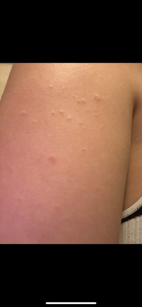 Can someone help ease my fears about HIV?