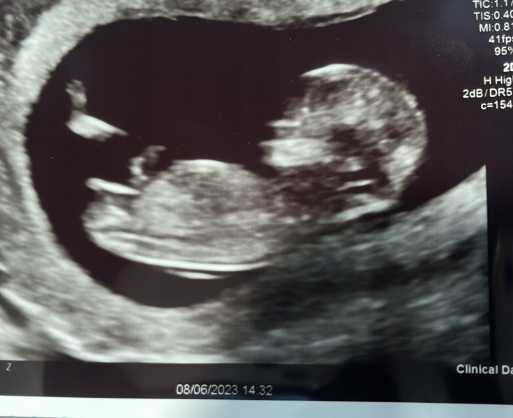 Gender prediction just for fun😁🥰
