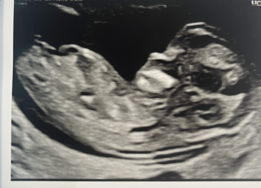 Due January 2024 🎉 PART 3