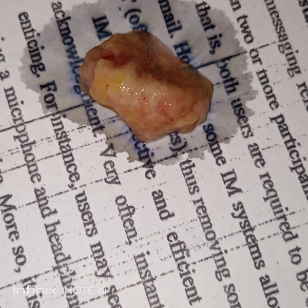 Any idea what this could be...GROSS PIC INCLUDED