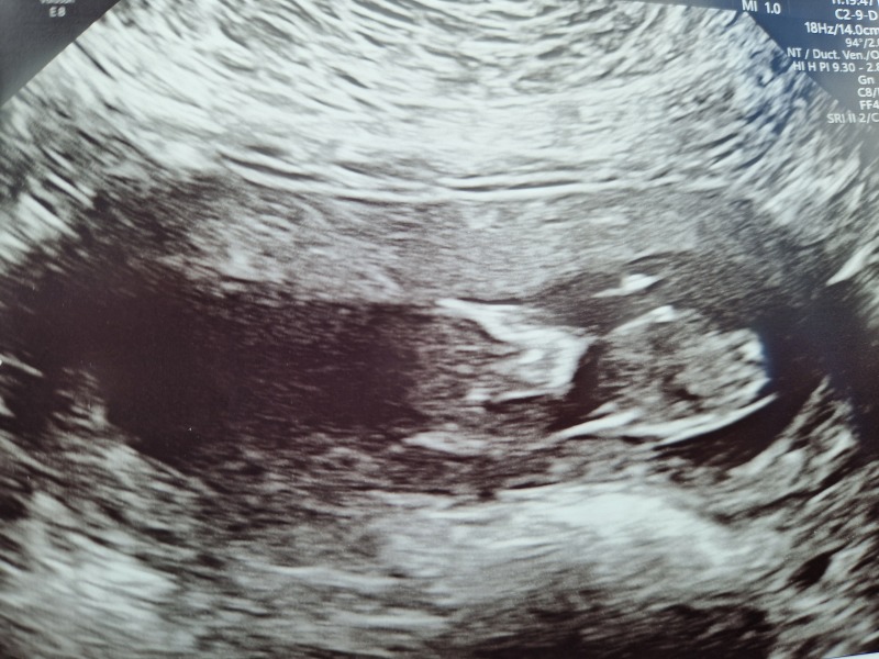 Due January 2024 🎉 PART 3