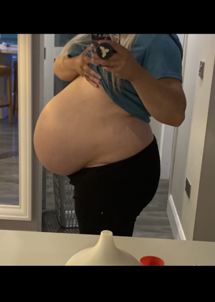 When did you deliver with polyhydramnios ?