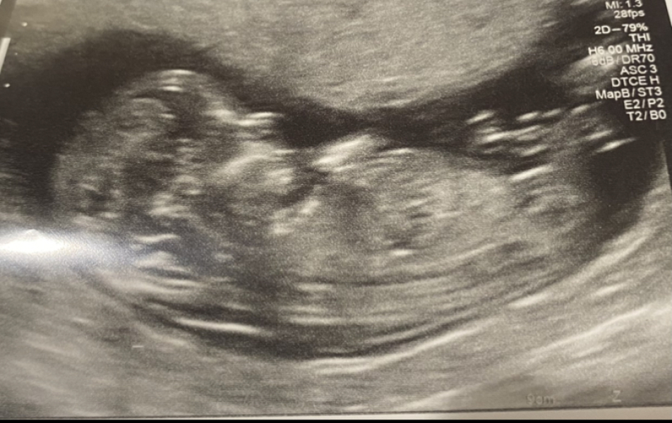 Due January 2024 🎉 PART 3