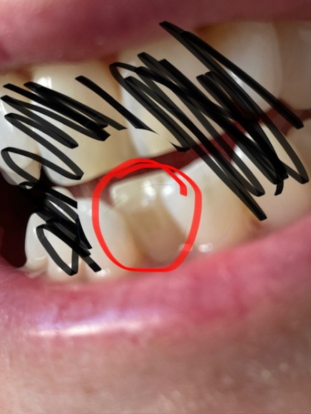 Any dentists around?