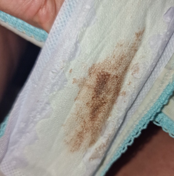 Implantation bleeding? 