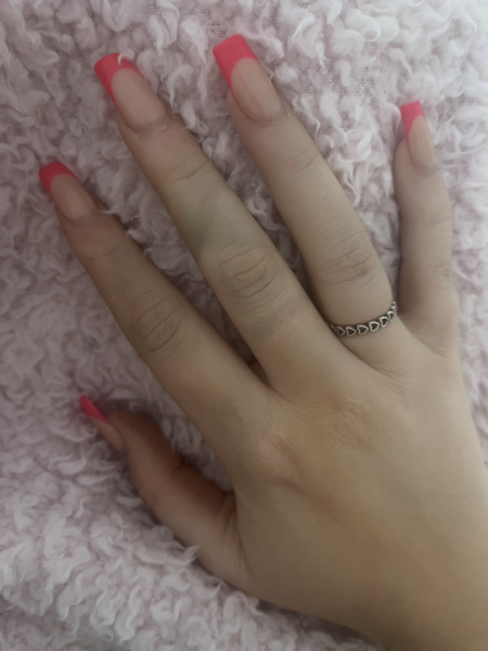 What's wrong with my hands / arms? (Pics included)
