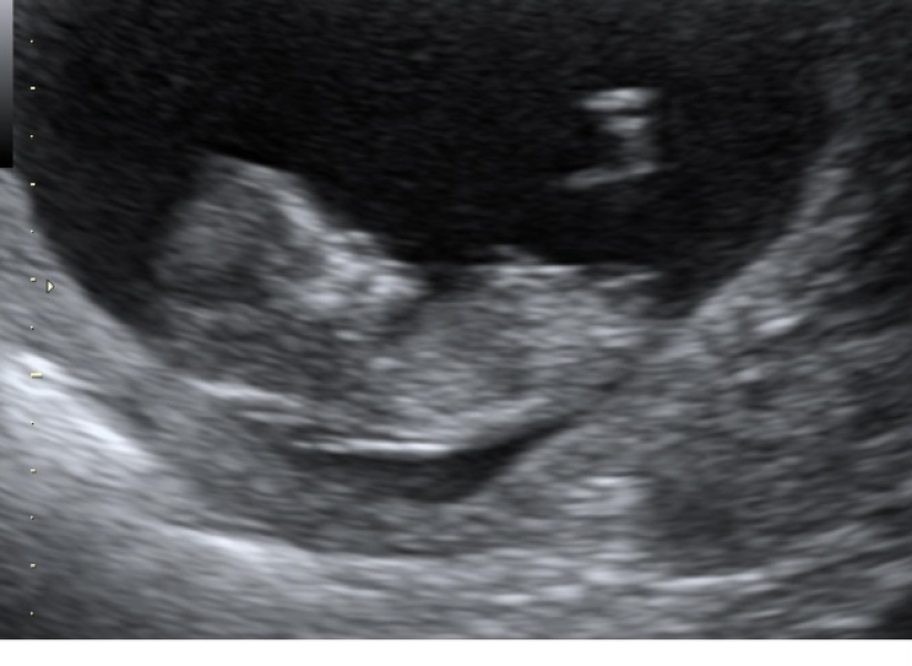 12 + 2 scan 💕 can you guess the gender ? 