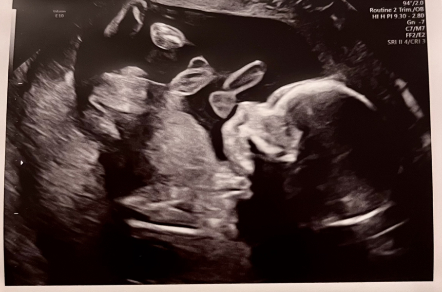 November 2023 babies - thread 4