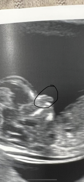 Abnormal scan
