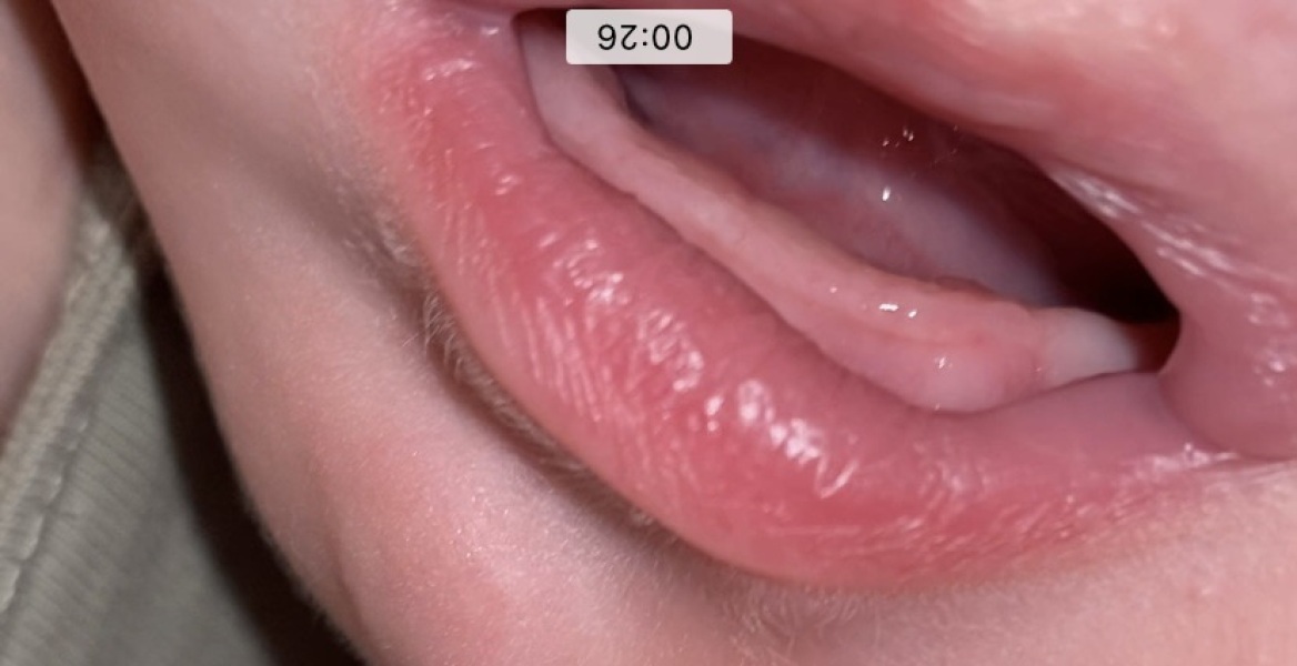 Baby teething or something else?