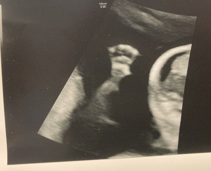 FET March 2023