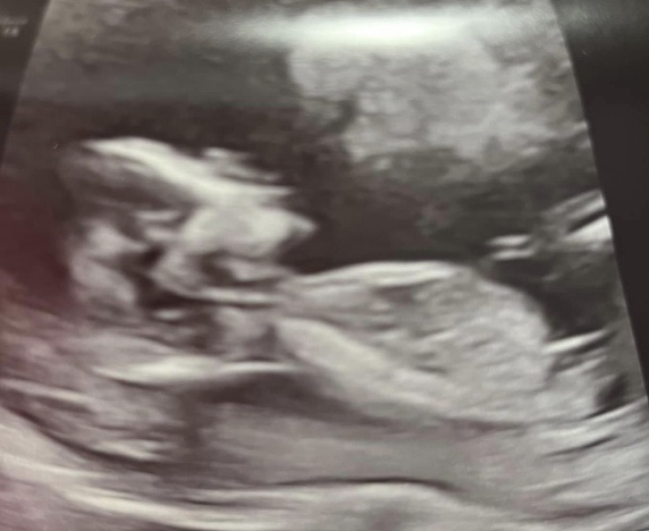 Boy or girl?
