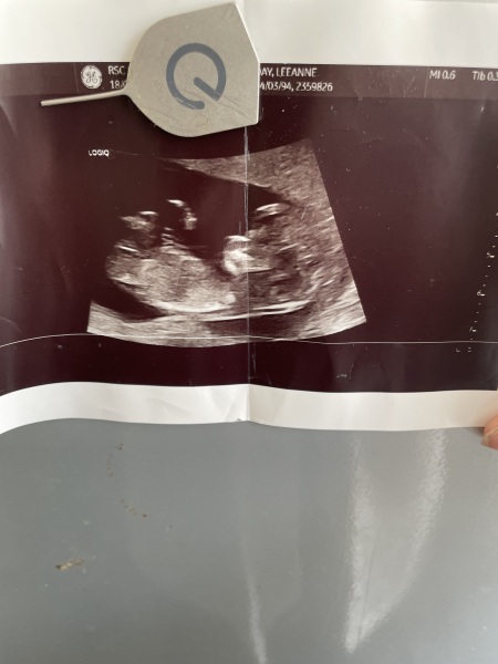 BOY OR GIRL!!!!!