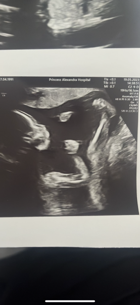 Due October 2023 - thread 7