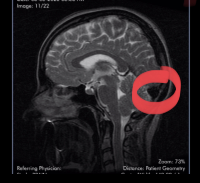 Brain scan - what is this??