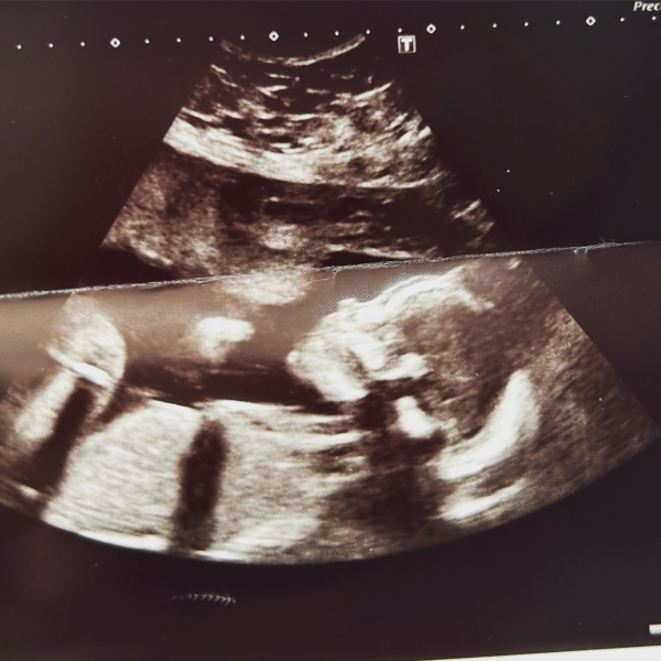 Due October 2023 - thread 7
