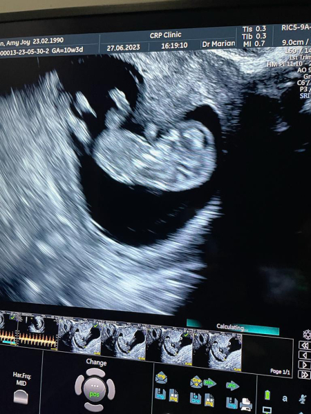 Due January 2024 🎉 PART 3