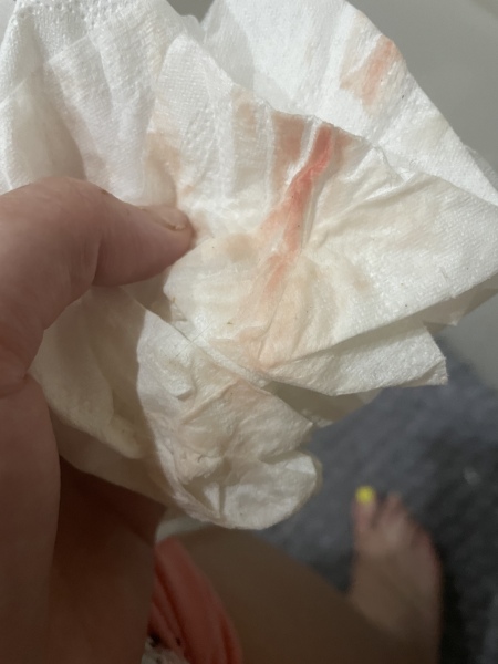 Implantation bleeding? 