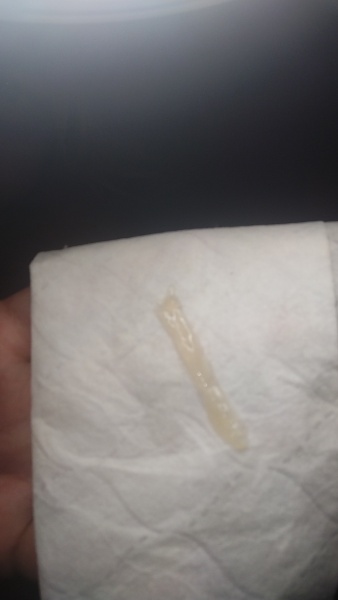 (GRAPHIC PICTURE) Is this fertile Mucus? Or Mucus Plug. sorry tmi !!!
