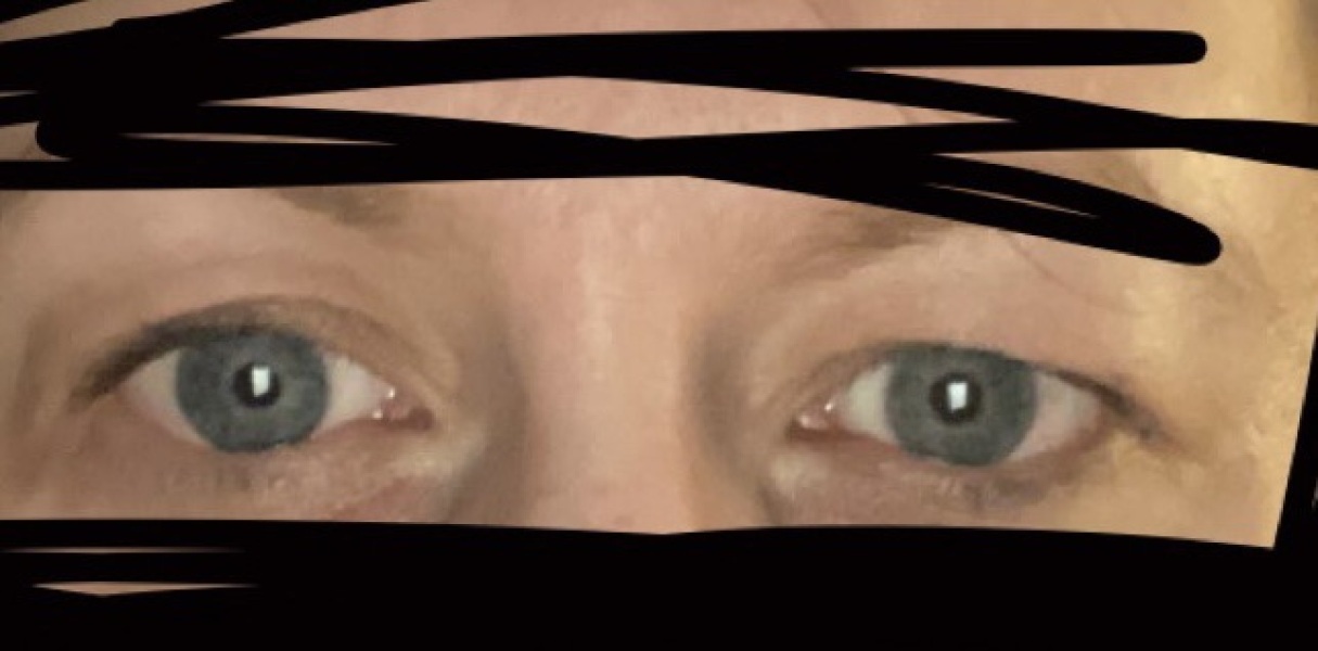 Is something wrong with my eye ? Pics included
