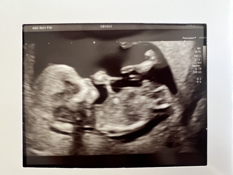 Due January 2024 🎉 PART 3