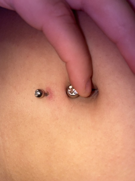 Does my belly button piercing look infected? (pic)