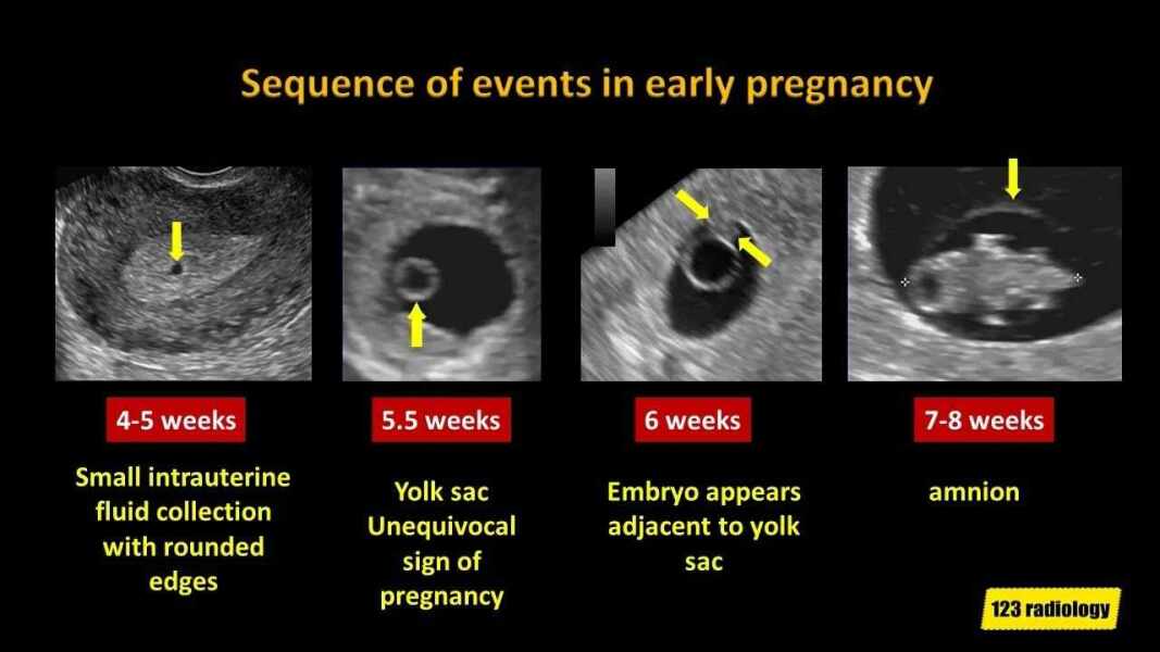 Ultrasound Help