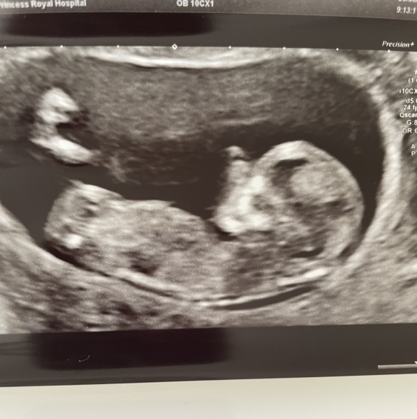 Due January 2024 🎉 PART 3