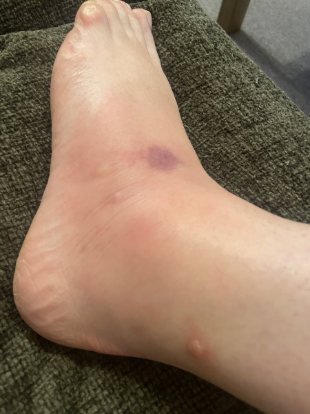 to think that mosquitos should not be a thing in the UK?