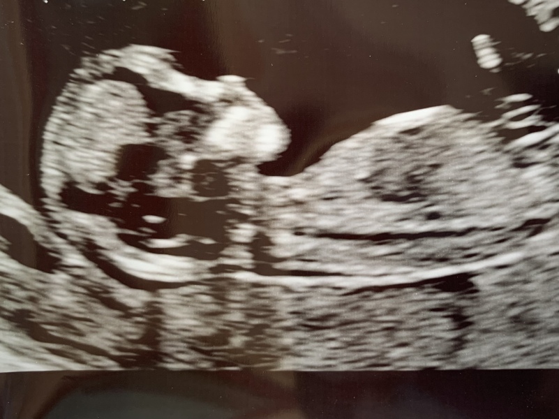 Due January 2024 🎉 PART 3