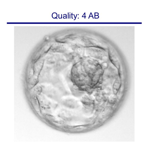 Trying to conceive over 40 part 4