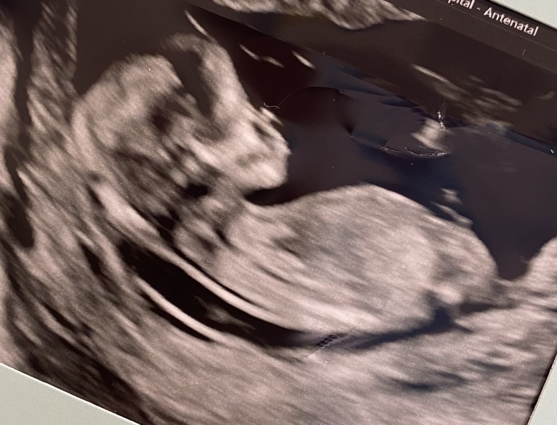 For fun- guess the gender :)