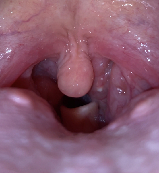 Does this look like tonsillitis? 