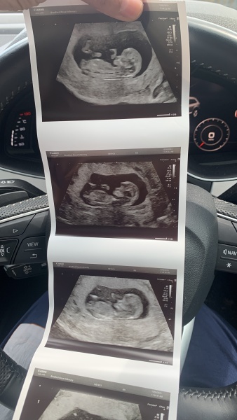 Due January 2024 🎉 PART 3