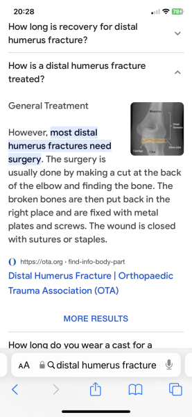 To wait for virtual Fracture Clinic