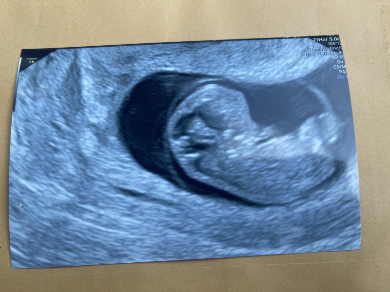 6 weeks and bleeding 