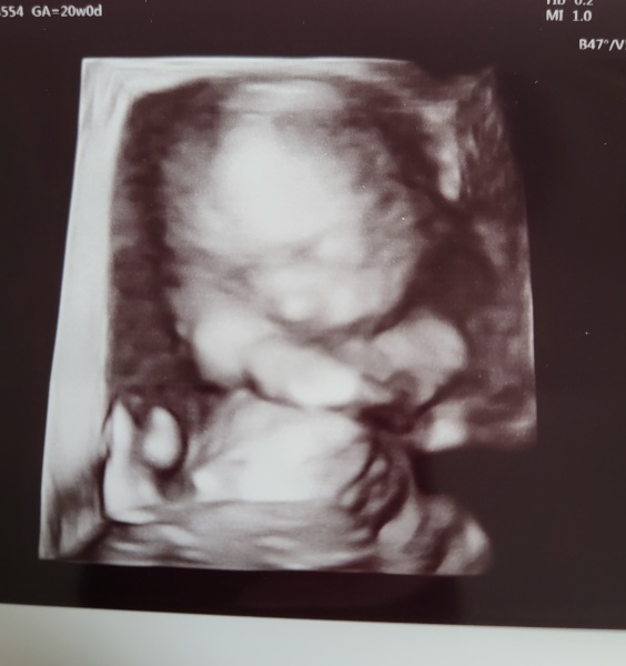 TWW - Testing Around 1st March 