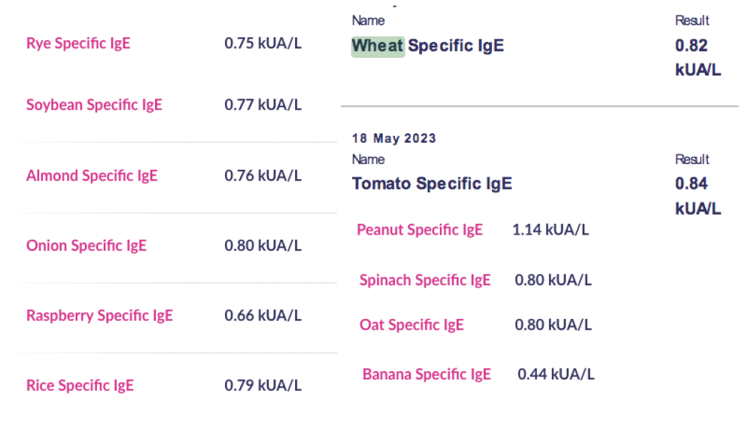 Coming to grips with new allergies in middle age
