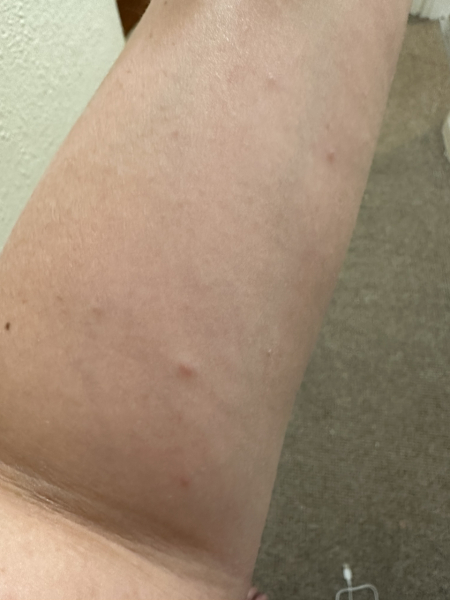 What do I do?! BEDBUGS