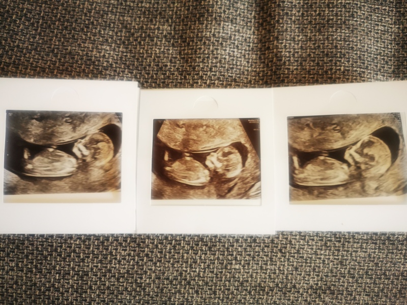 Nub theory - 13 weeks and 1 day