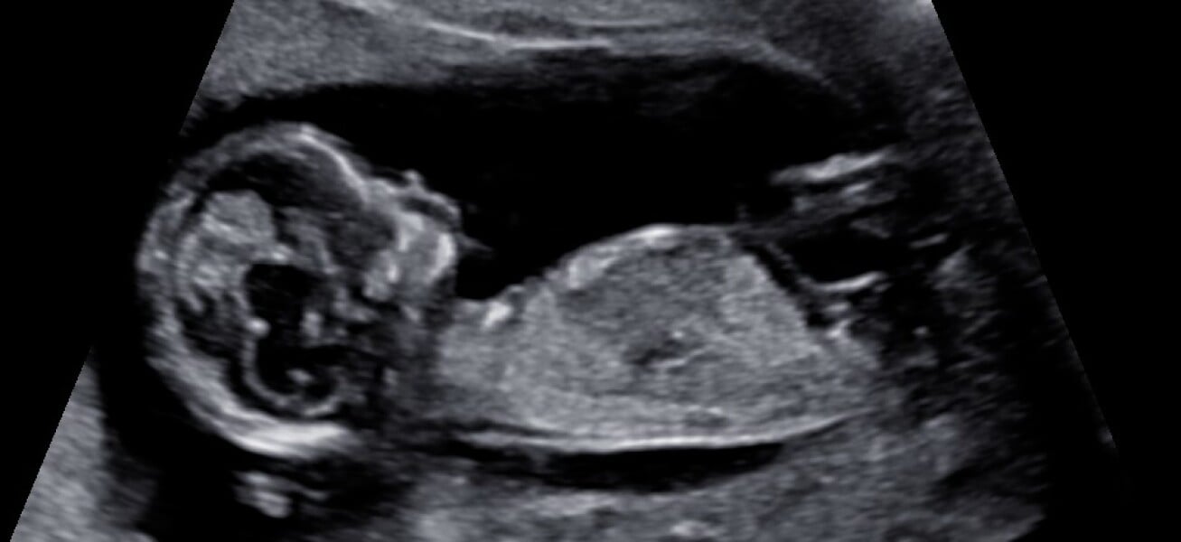boy or girl