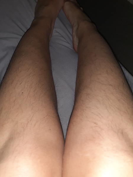 Is excessive body hair revolting?