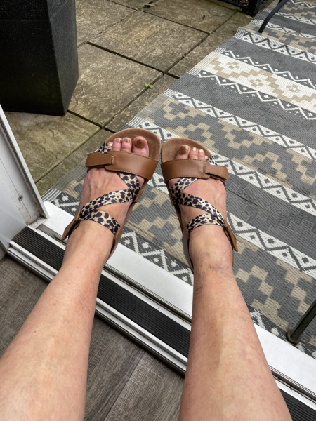 Show me a pic of your bunions…