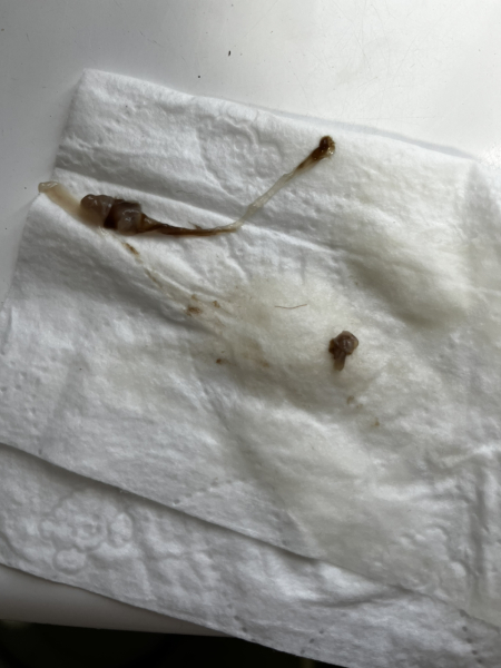 Pregant after miscarriage - support thread