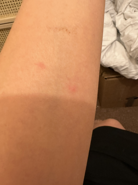 What do I do?! BEDBUGS
