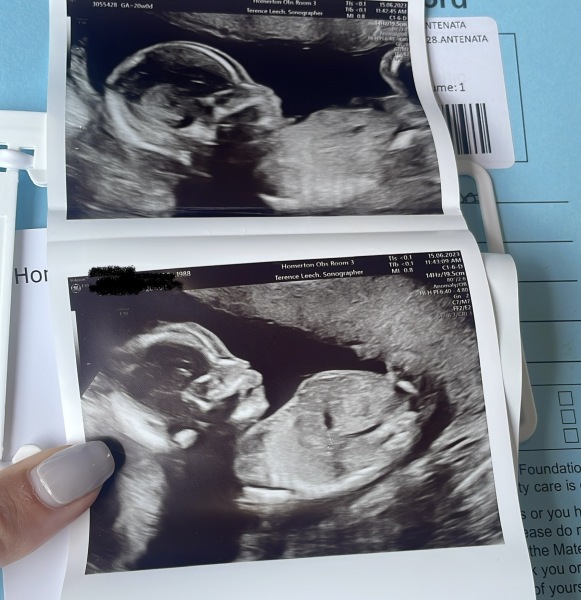November 2023 babies - thread 4