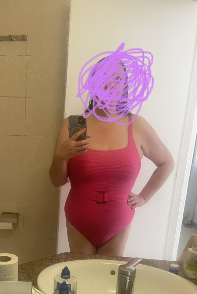 Tummy Tuck consultation