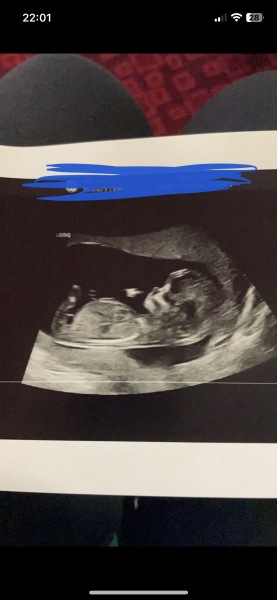 BOY OR GIRL!!!!!