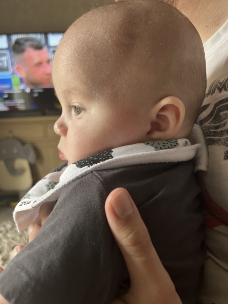 is this a normal 5 month old head? Advice please worried ftm